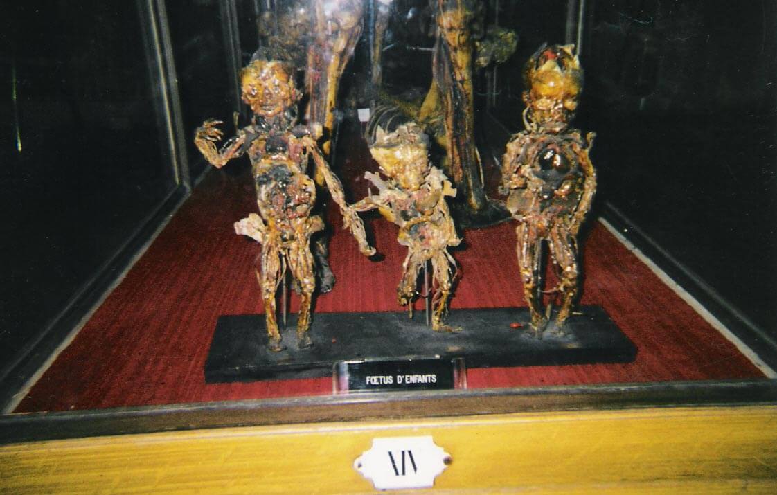 Fragonard’s Flayed Dancing Babies